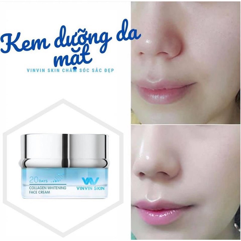 KEM DƯỠNG TRẮNG PHỤC HỒI DA BỊ HƯ TỔN - Collagen Whitening Face Cream - Vinvinskin