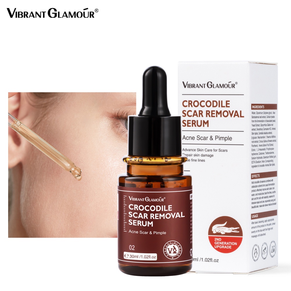 Vibrant Glamour Scar Repair Serum 30ml Điều trị mụn cá sấu thế hệ 2 Loại bỏ vết rạn da Loại bỏ sẹo mụn Dưỡng ẩm Chăm sóc da Beauty metro | BigBuy360 - bigbuy360.vn