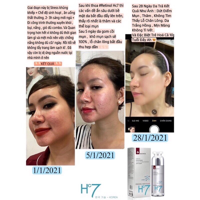 RETINOL HC7 MỸ PHẨM HUYỀN CÒ