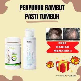 (Hàng Mới Về) 1 Hộp Đựng Tóc Giả Kích Thích Mọc Tóc Angelica 1 Không Gây Rụng Tóc No. 1