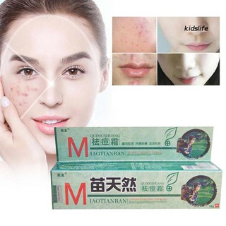 Ready Stock Acne Remove Cream Blemish Spot Pimple Treatment Moisturizing Facial Skin Care 