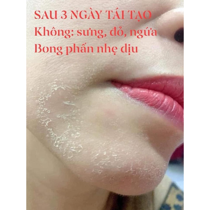 Bách Y Sâm 03 Plus CHUYÊN NÁM 45ml (Mẫu Mới Của Bạch Linh 3)