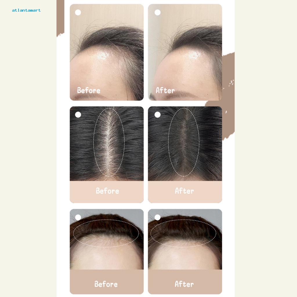 Atl| Thỏi Kem Che Khuyết Điểm Chân Tóc Tự Nhiên 1.8g