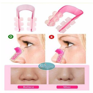 Kẹp nâng mũi  Nose Up