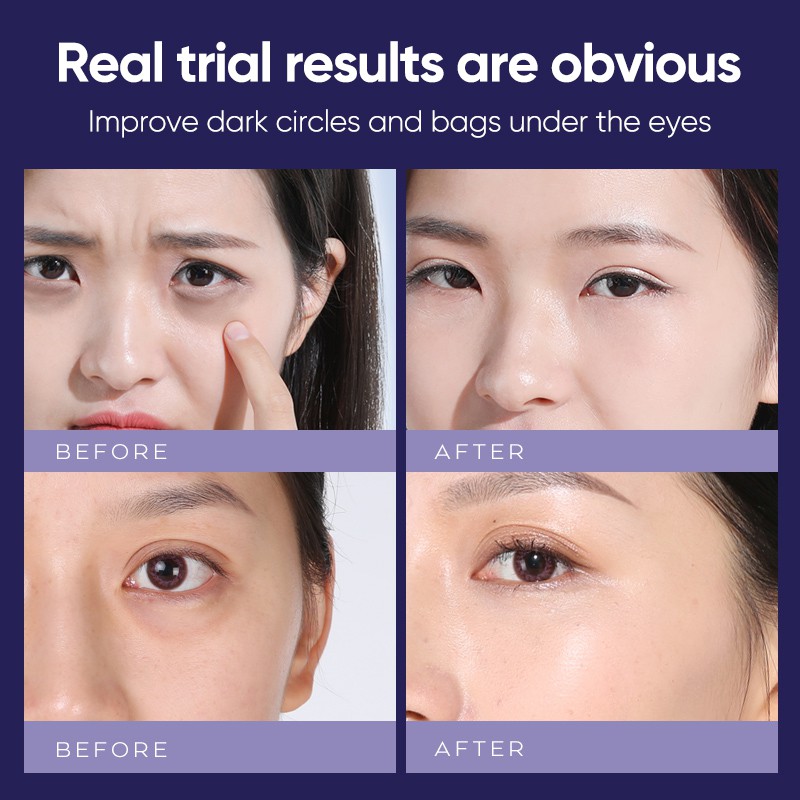 Kem dưỡng mắt YaMaLiSa 20g Chiết Xuất Nọc Rắn Dùng Mát Xa Hiệu Quả | BigBuy360 - bigbuy360.vn