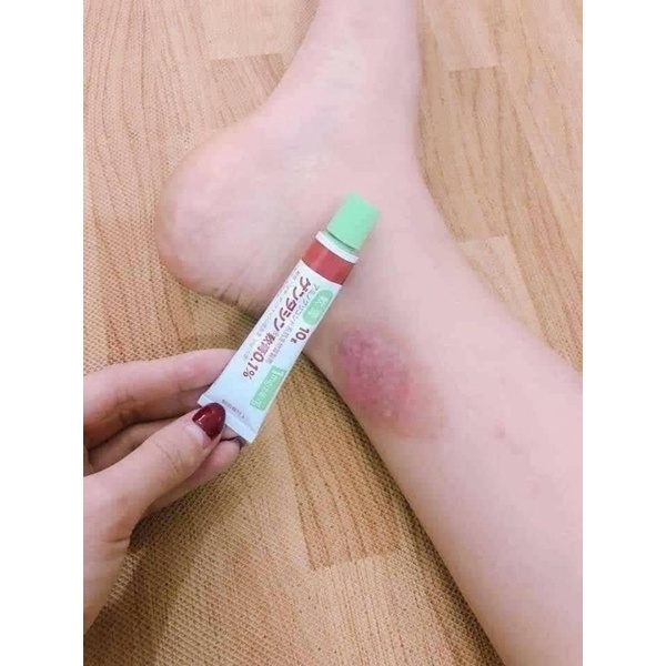 Gel giảm thâm sẹo Gentacin Nhật Bản 10gr giảm mụn bọc mụn mủ mụn thâm - Tái tạo da liền sẹo mờ sẹo 06