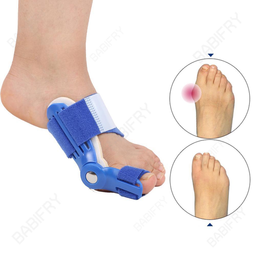 Dụng cụ nẹp chỉnh ngón chân cái an toàn tiện dụng