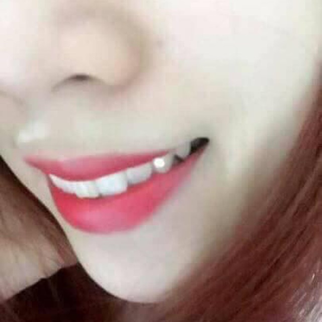 10v đá đính răng combo