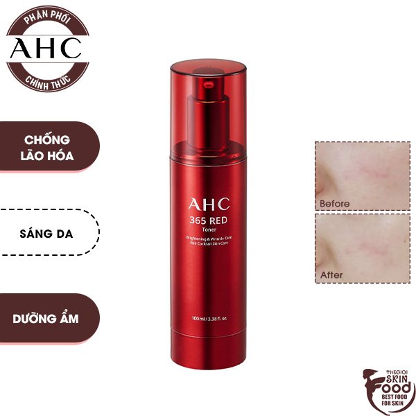 Nước Hoa Hồng Chống Lão Hóa, Làm Sáng Da AHC 365 Red Toner 100ml