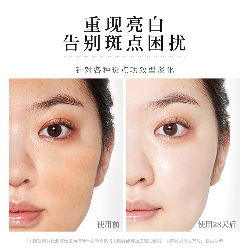 Sữa dưỡng giảm nám và chống tàn nhang thảo dược BAIZTON 80ml da trắng sáng không tì vết - Hiệu quả chỉ 28 ngày A262