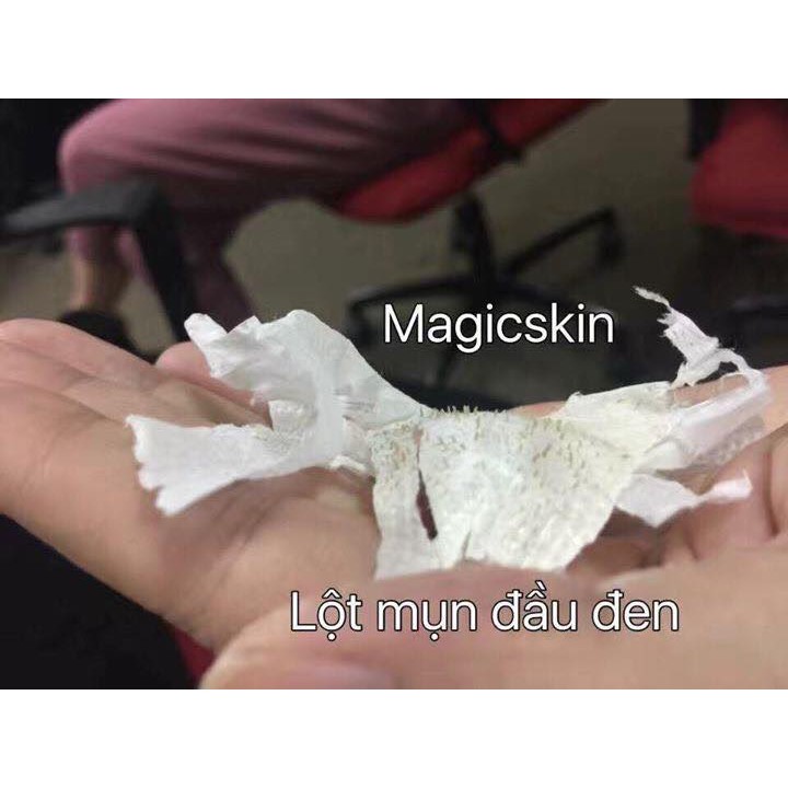 Lột mụn đầu đen