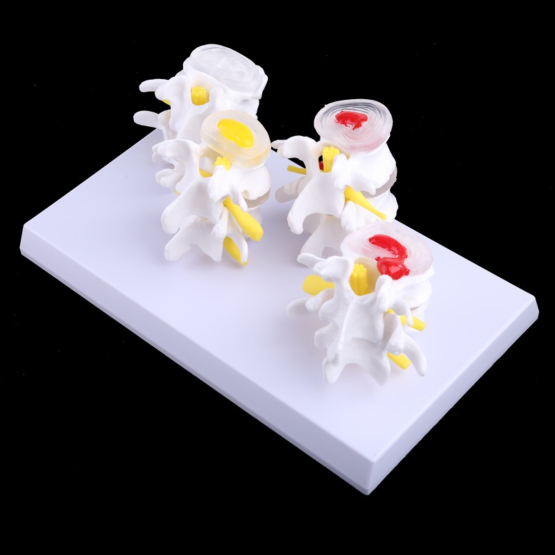 1 Bộ Mô Hình Tượng Người Giảng Dạy Y Tế