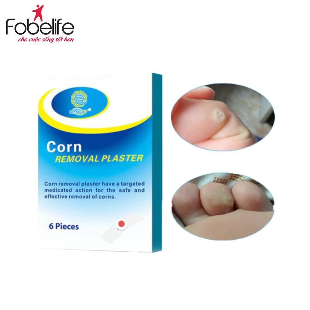 [Mã FMCGMALL -8% đơn 250K] Miếng Dán Mụn Cóc Corn plaster KangDi Fobe - hộp 6 miếng