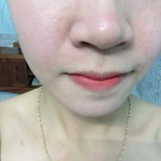 Thảo dược tái tạo da