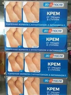 Kem trị nứt chân Nga Kpem 50ml
