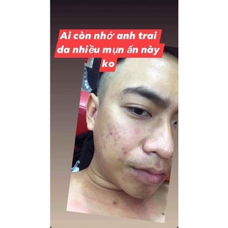 combo thần thánh siêu trắng da mặt