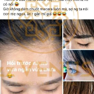 [CHÍNH HÃNG] Serum Dưỡng Mi Siêu Dài Zzvenus [Bản nâng cấp KING VENUS]
