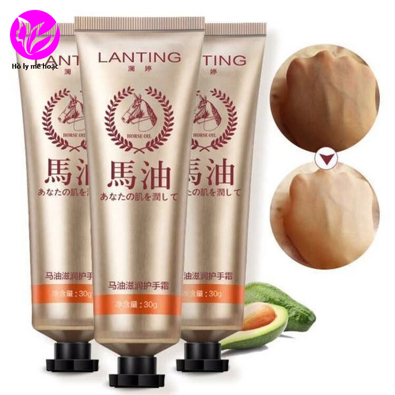 Kem tinh dầu ngựa dưỡng ẩm làm trắng da tay chống lão hóa 30g | BigBuy360 - bigbuy360.vn