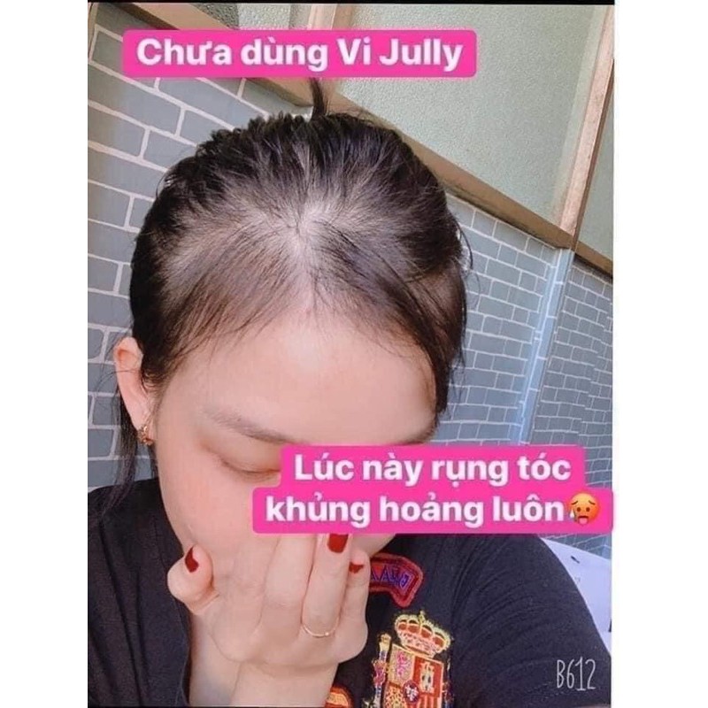 TINH DẦU BƯỞI KÍCH THÍCH MỌC TÓC | BigBuy360 - bigbuy360.vn