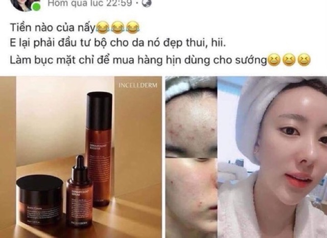 [Mã COS1904 giảm 8% đơn 300K] Set Dưỡng Incellderm dưỡng trắng căng bóng | BigBuy360 - bigbuy360.vn