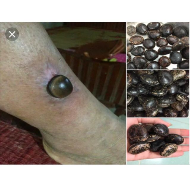 Hạt đậu lào ( hạt trị chó dại cắn) 10k/hạt