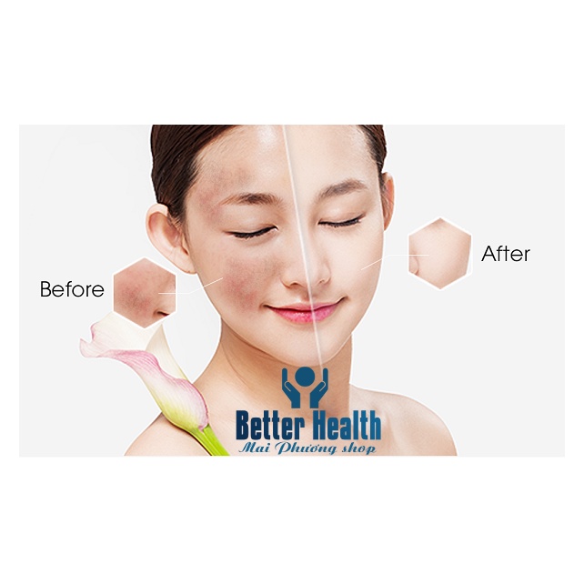 Kem dưỡng da NHAU THAI CỪU Lanolin Careline Của Úc | BigBuy360 - bigbuy360.vn