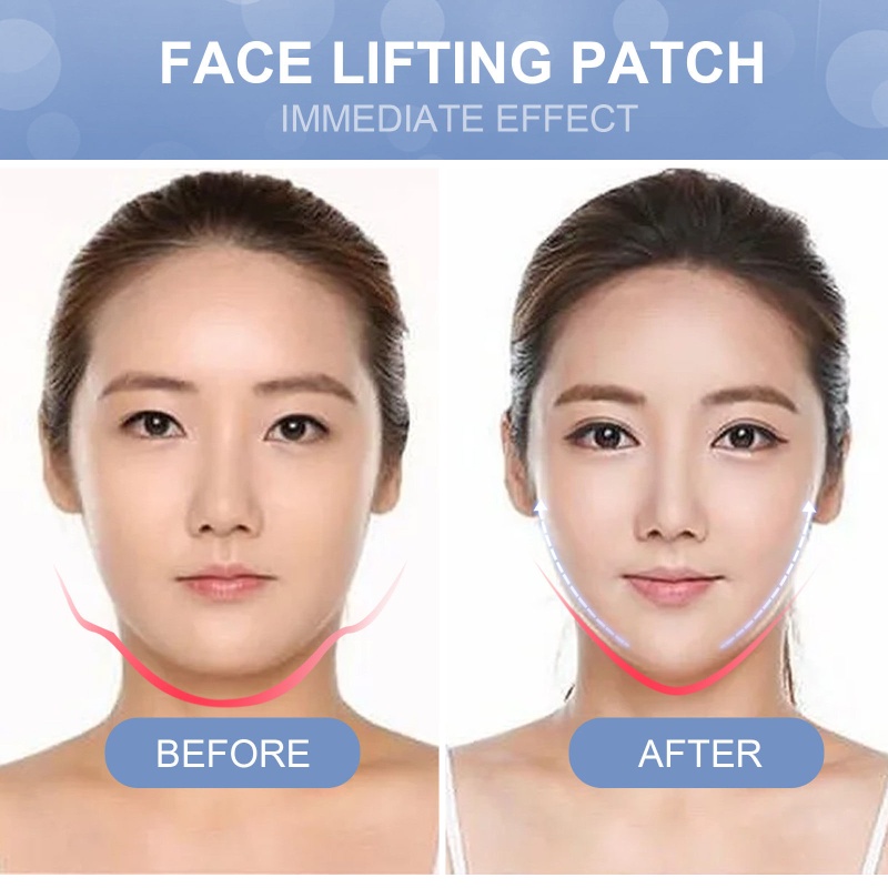 Băng Quấn Nâng Cơ Mặt Chống Nếp Nhăn Hiệu Quả YOUYO