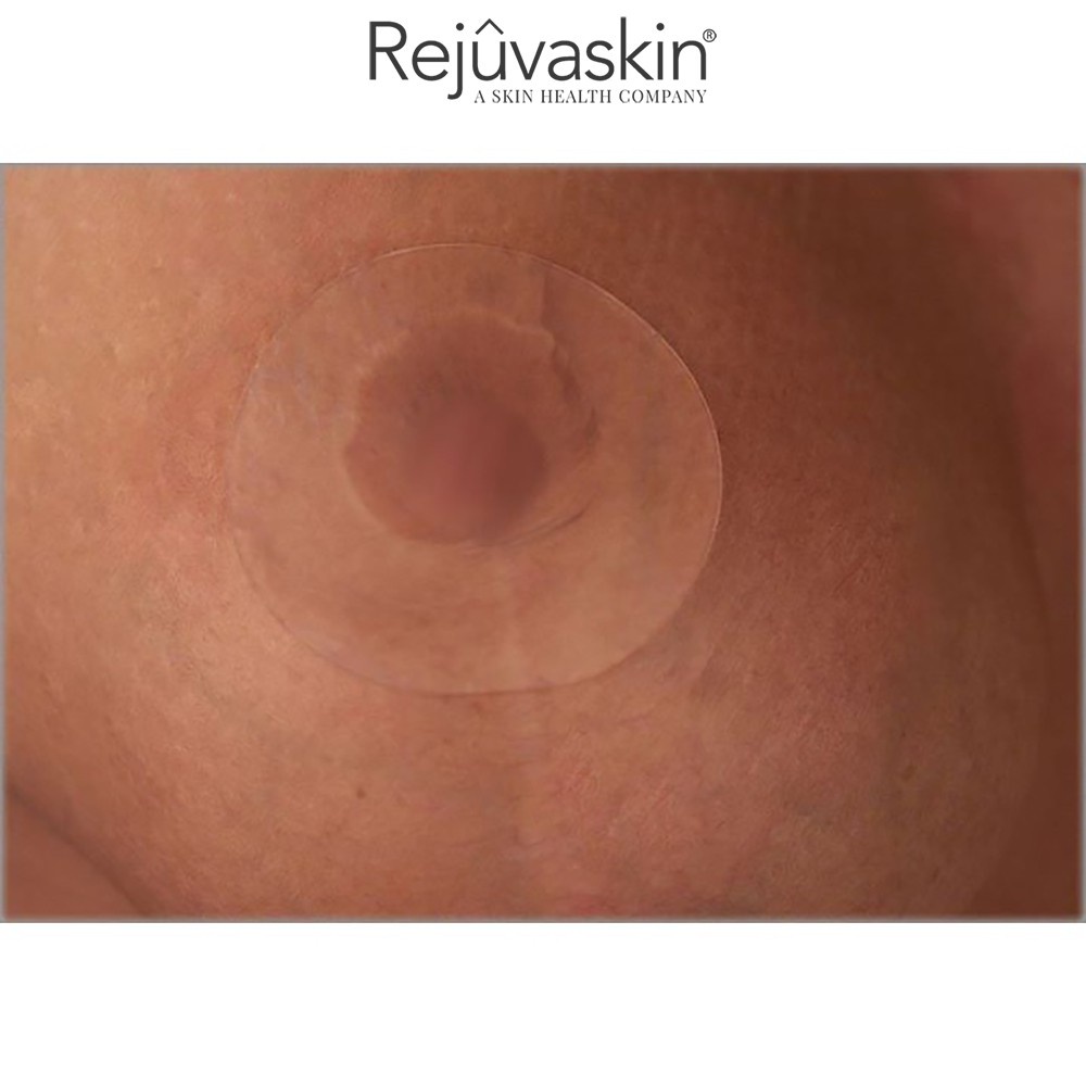 Miếng dán xóa mờ sẹo, phục hồi da hình tròn Scar FX Breast Circle - REJUVASKIN - AJA'S SKINLAB