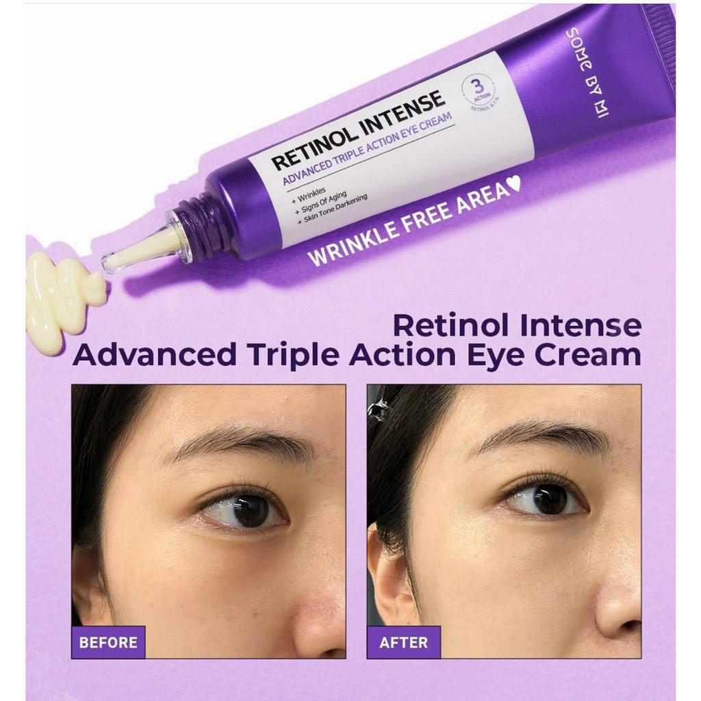 Kem Dưỡng Mắt Giảm Quầng Thâm, Chống Lão Hóa Some By Mi Retinol Intense Advanced Triple Action Eye Cream 30ml