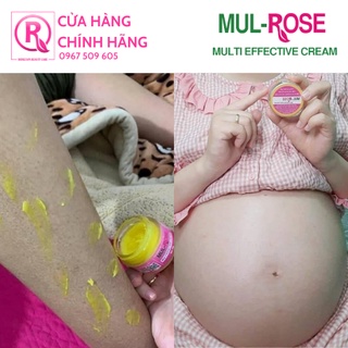 Combo 5 Kem đa năng MUL-ROSE