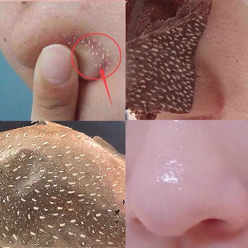 Mineral Mud Mask Peel Off Blackheads Shrink Pores