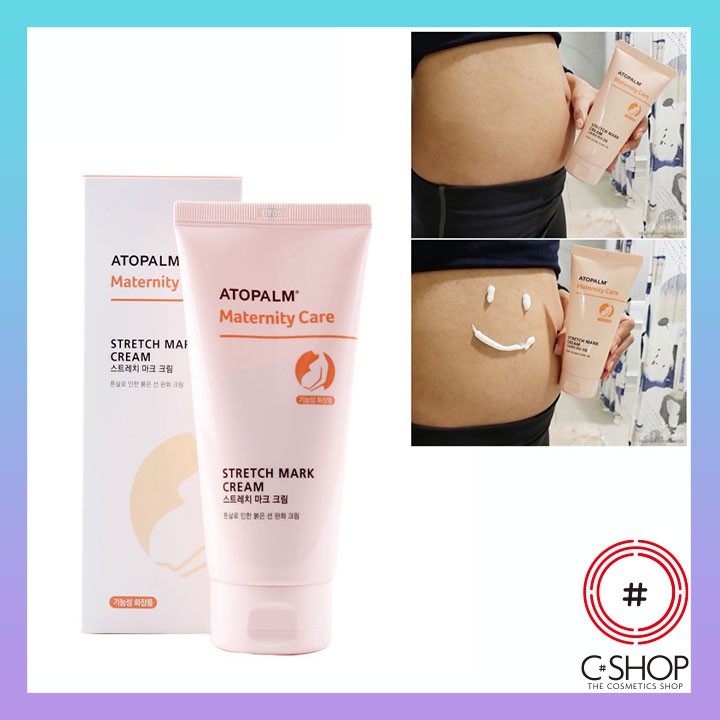 Kem Dưỡng Hạn Chế Rạn Da Cho Mẹ Bầu ATOPALM MATERNITY CARE STRETCH MARK CREAM_Mỹ phẩm Hàn Quốc chính hãng