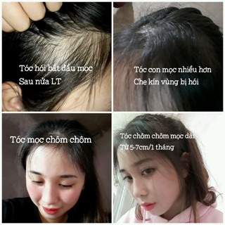 Combo Thảo Dược Gội Đầu và Xả Mộc