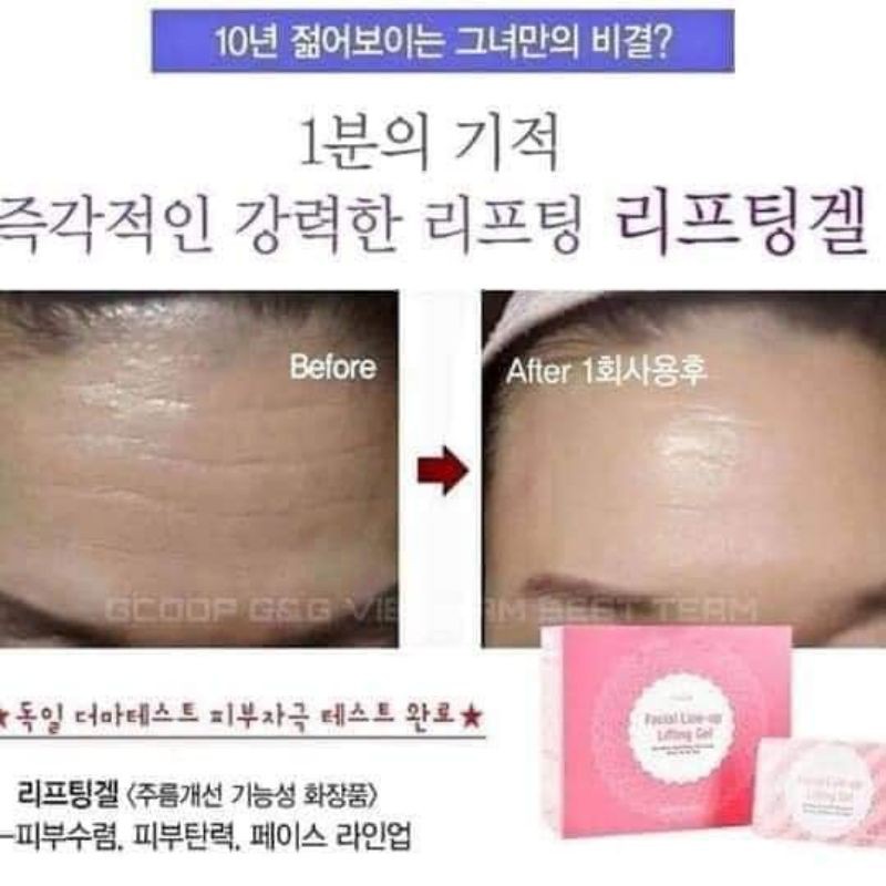 Gel nâng cơ mặt Care Cella Hàn quốc