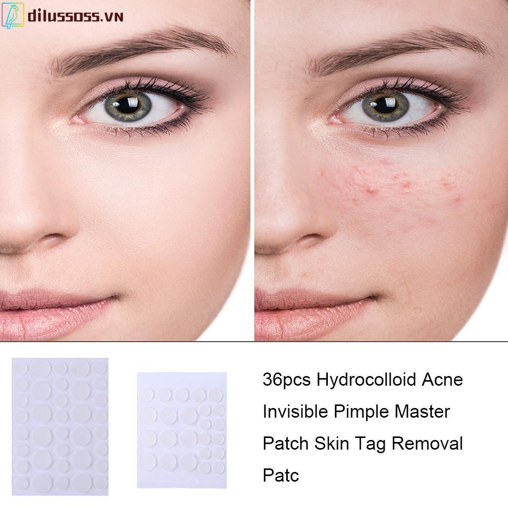 Bộ 24/36 miếng dán Hydrocolloid hỗ trợ loại bỏ mụn thoáng khí chăm sóc da mặt