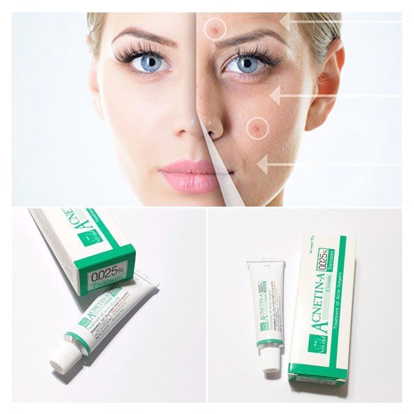 Tretinoin Acnetin-A Cream 👉Chính hãng👈 Kem bôi mụn - Thái Lan | BigBuy360 - bigbuy360.vn