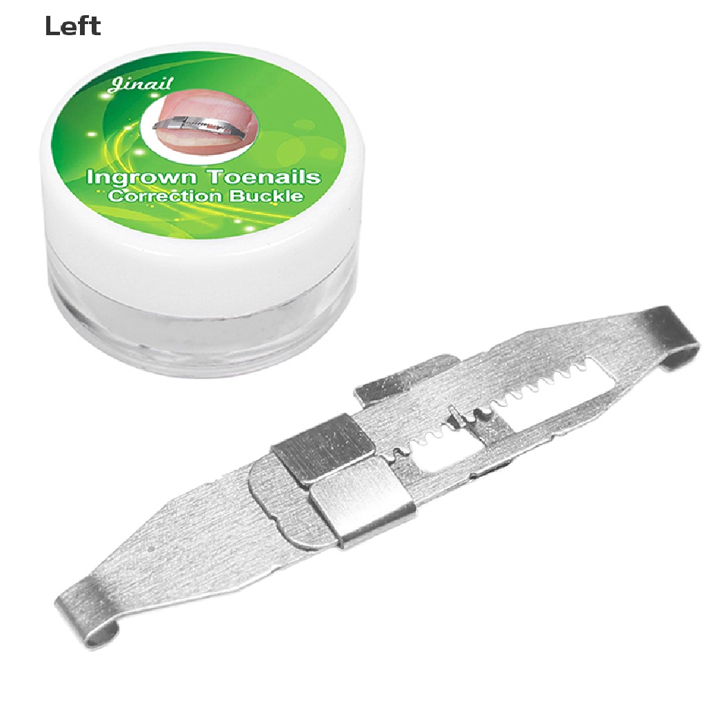 [Hàng mới về] 1 miếng dán chỉnh sửa móng chân mọc ngược