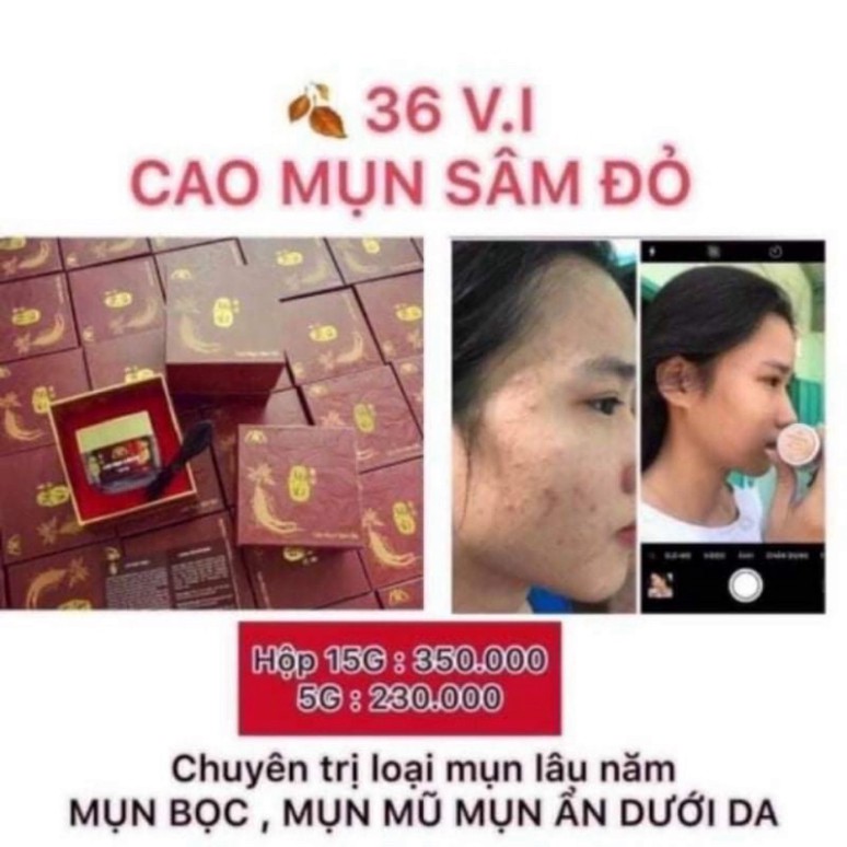 (Mua 1 tặng 1 gel hút mụn) Cao mụn sâm đỏ 15g-chính hãng 100% tặng 1gel hút mụn | BigBuy360 - bigbuy360.vn