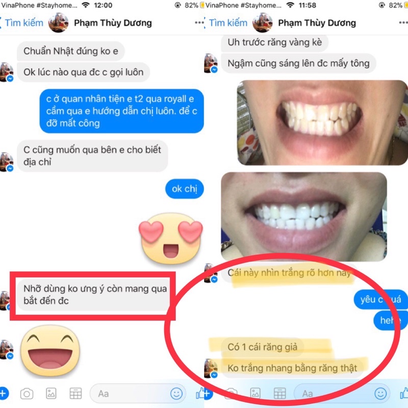 Bộ kit làm trắng răng CONG FANSDR  Nhật Bản, tẩy trắng hiệu quả, không ê buốt