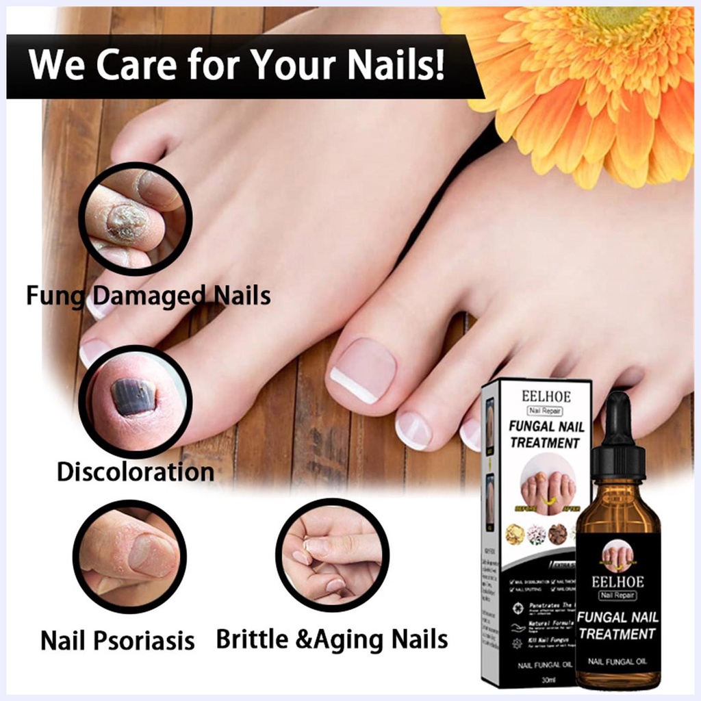 Tinh Chất Phục Hồi Móng Chân Và Móng Tay