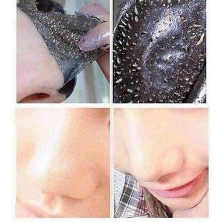 GEL LỘT MỤN THAN TRE