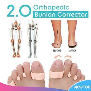 Dụng cụ tách ngón chân điều chỉnh hỗ trợ cải thiện bệnh biến dạng ngón chân hiệu quả cho mọi người