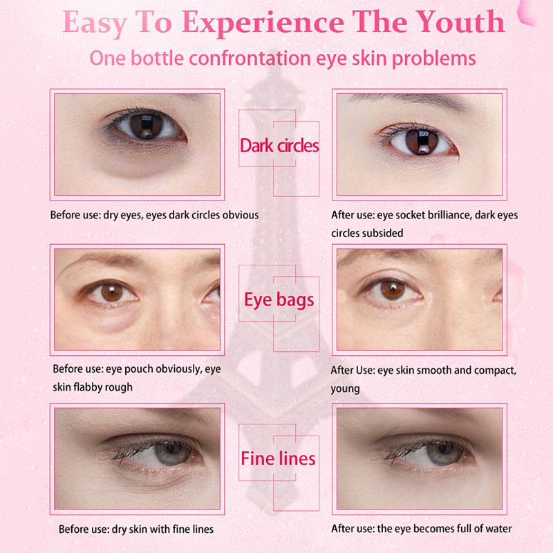 XIXI Kem dưỡng da mắt OEDO 20g chống lão hóa và nếp nhăn
 | BigBuy360 - bigbuy360.vn