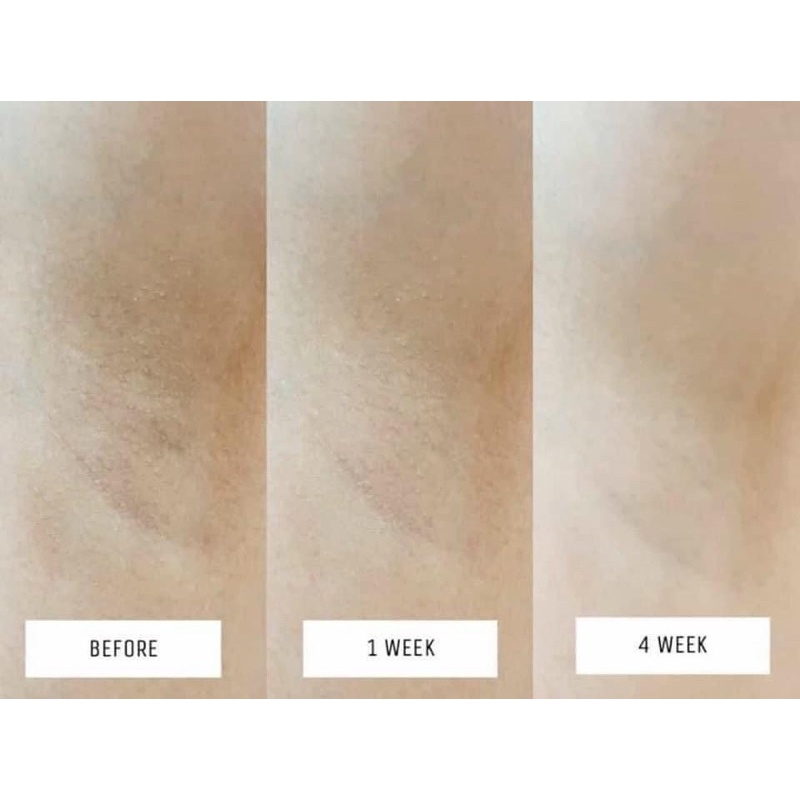 Kem Thâm Nách Thái Lan Tone Up Vaseline Dry Serum Ultra Bright Thâm Nách Thái Lan Kem Trắng Nách