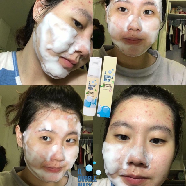 Sữa Rửa Mặt Thải Độc Oxy Bubble Mask
