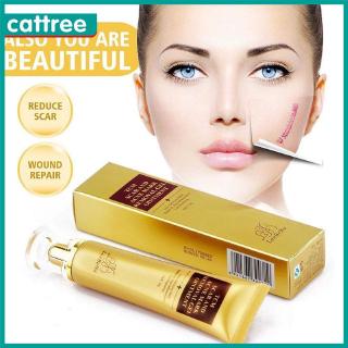 [Hàng mới về] LANBENA Original Acne Scar Removal Cream Skin Repair Face Cream