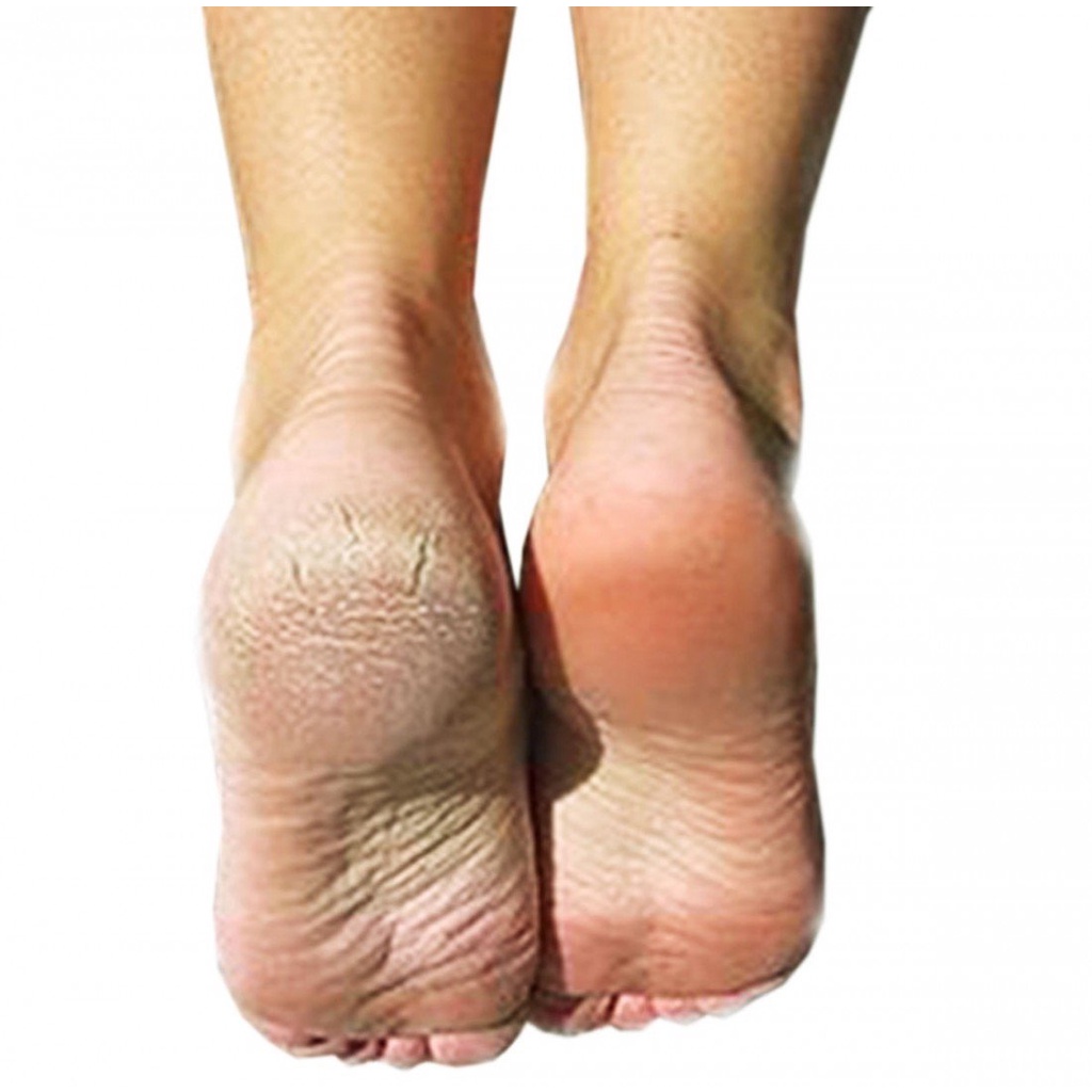 Dụng Cụ Chà, Dũa Gót Chân tiện dụng