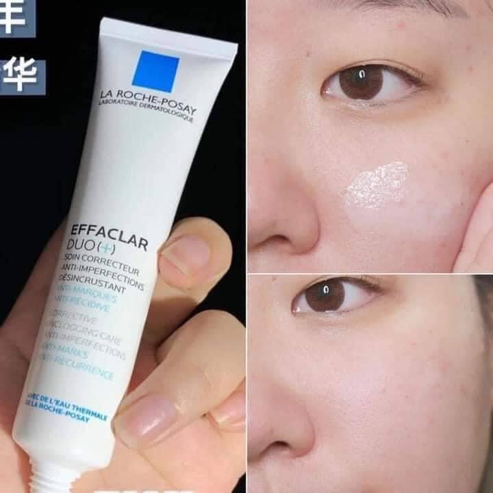 Kem dưỡng giảm mụn La Roche-Posay Effaclar Dou+ tuýp 15ml