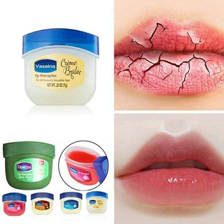 (SỈ = LẺ) Dưỡng nẻ môi Vaseline