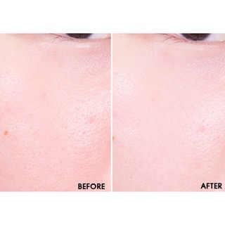 Kem Dưỡng Trắng Da V7 Toning Light 15ml